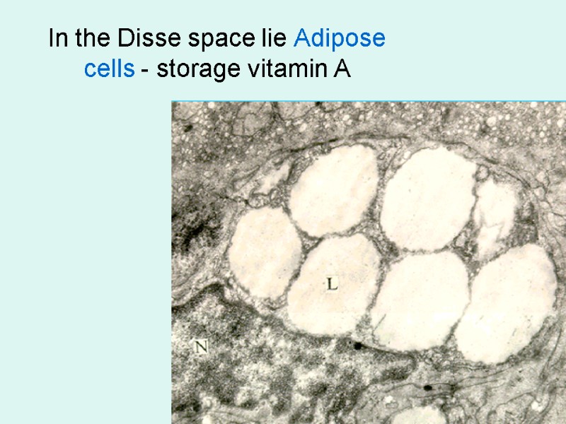 In the Disse space lie Adipose cells - storage vitamin A